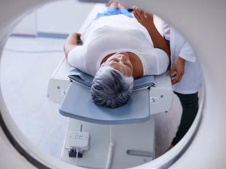 ctscan